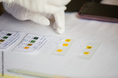 Doctor check blood group of patient or donor by mixing the sample with reagent