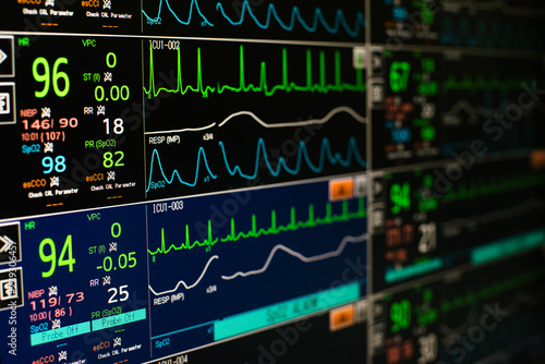 Modern vital signs monitor display at ICU in hospital.