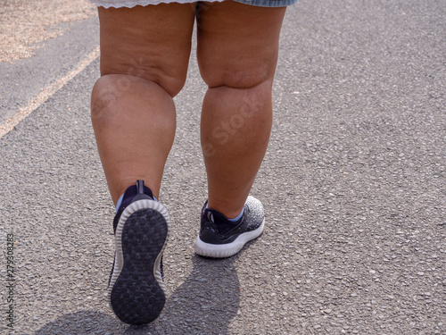 Close up leg fat women running shoes is walking on the street alone.