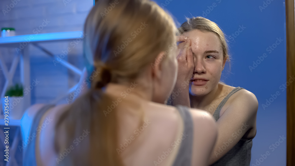 Teenage female popping pimple face suffering insecurities, puberty hormones Teenage female popping pimple face suffering insecurities, puberty hormones