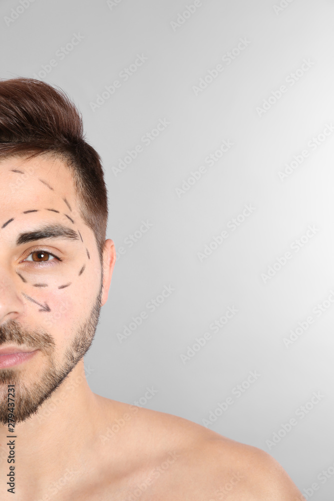 Fototapeta premium Young man with marks on face for cosmetic surgery operation against grey background, space for text