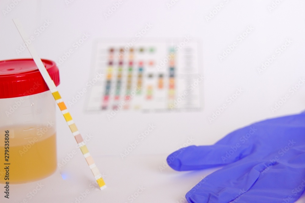 Urine test strip, container, gloves and test chart on white background Urine test strip, container, gloves and test chart on white background