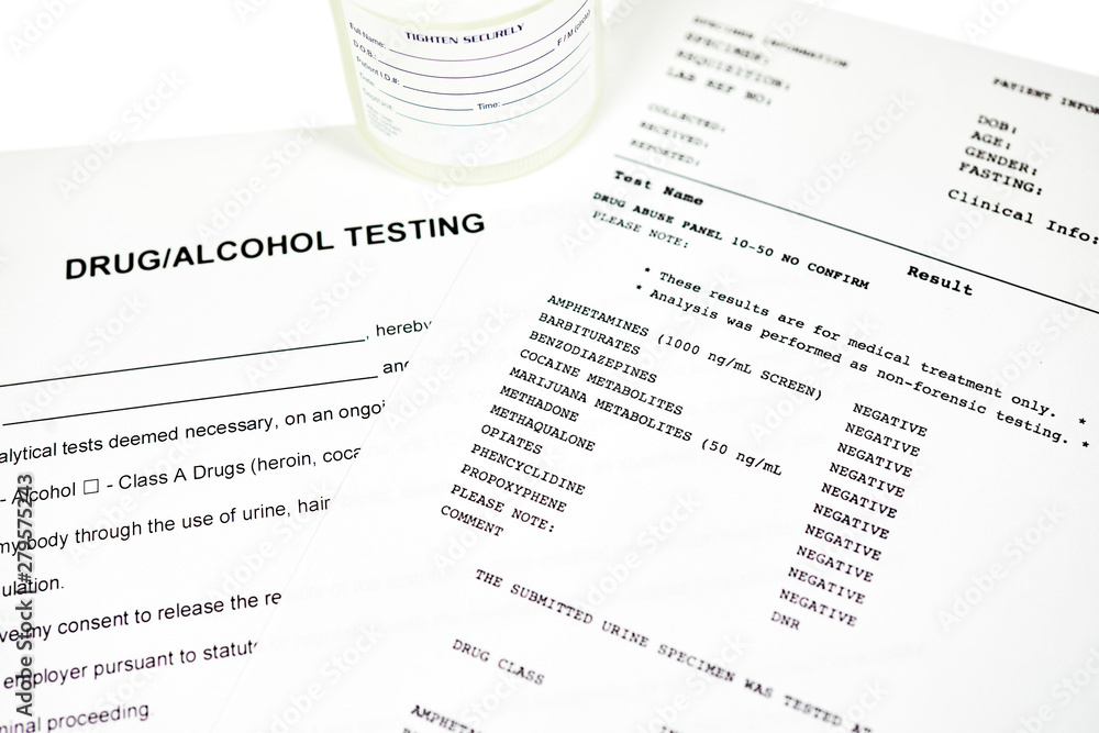 Obraz premium Drug Abuse Panel Lab Report