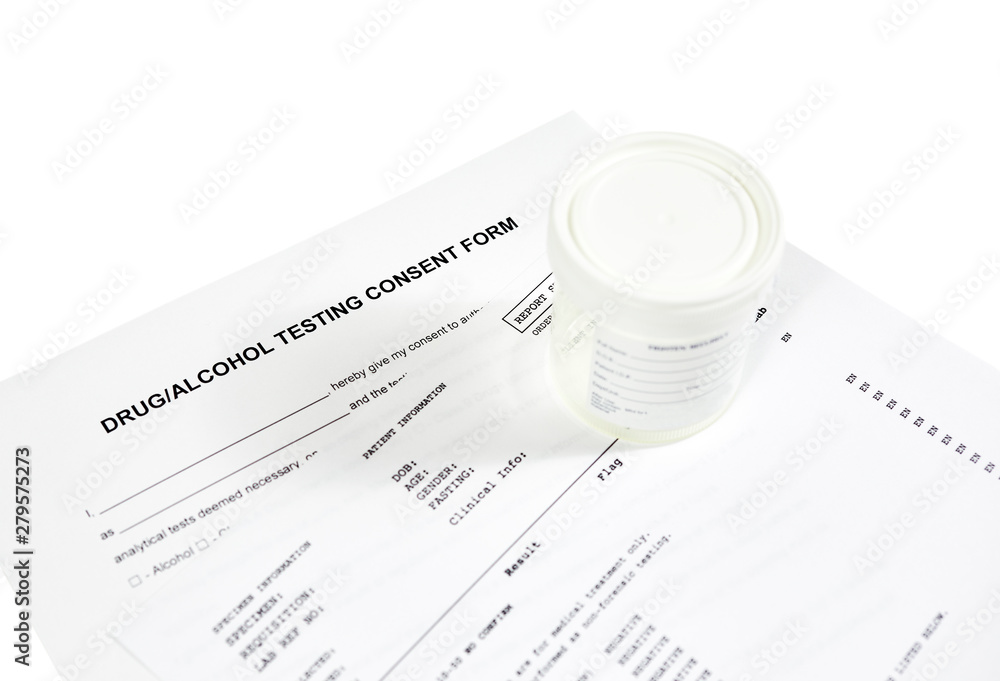 Drug and alcohol testing consent form with sterile urine container and
