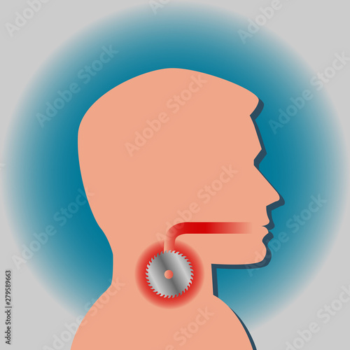 Sore throat feels like a saw blade in the throat vector infographic