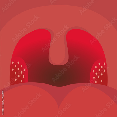 Tonsilitis, sore throat vector illustration