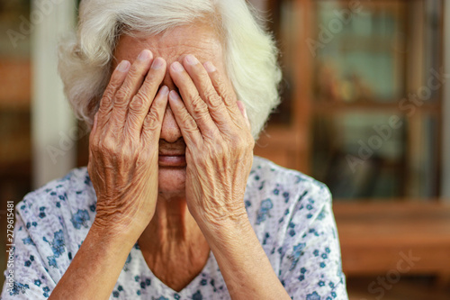 Asian woman with white hair shows signs of memory impairment. Health problems and treatment costs.