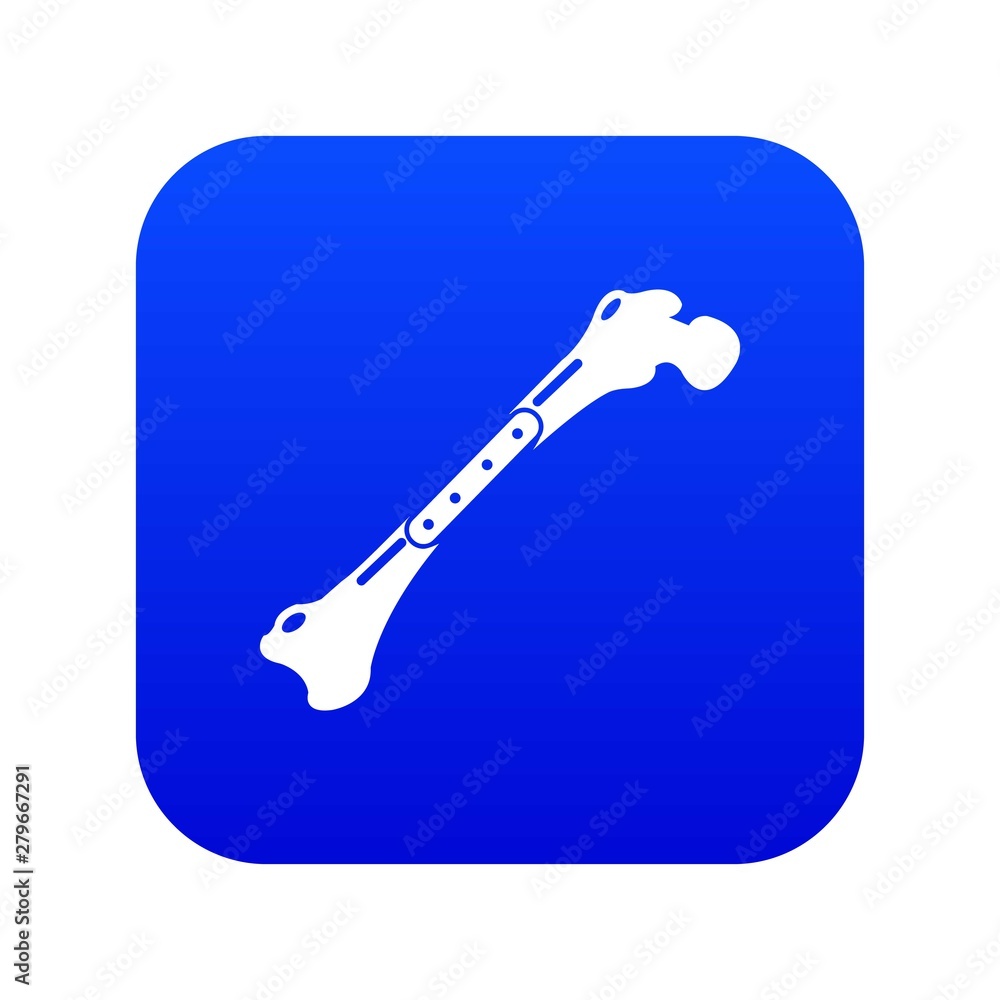 Broken bone icon. Simple illustration of broken bone vector icon for ...