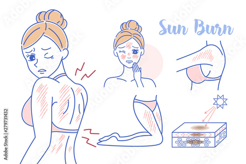 beauty cartoon woman with sunburn