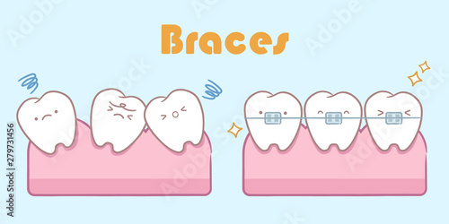 cartoon tooth with dental care
