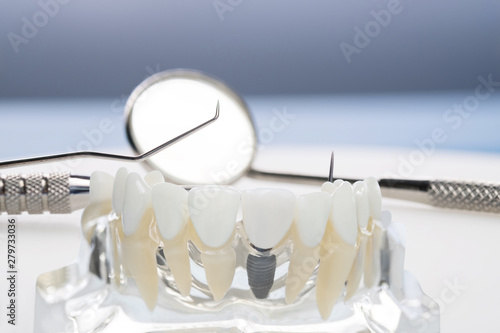 implant and orthodontic model and tools for student to learning teaching model showing teeth. photo