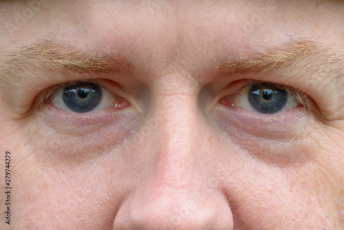 Close up on the blue eyes of a redheaded man