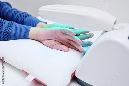 Bild auf Leinwand hands of a patient with psoriasis close-up under an ultraviolet lamp