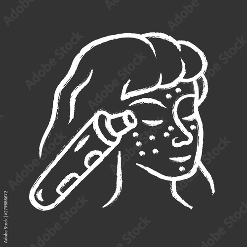 Blackhead remover chalk icon. Pore cleaner. Vacuum comedone removing. Beauty device for home use. Home cosmetology procedure. Beauty instrument. Isolated vector chalkboard illustration