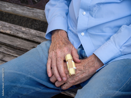 Fotografi Mans hand with an improvised splint on finger
