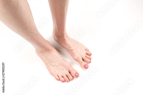 female legs with transverse flat feet and protruding veins