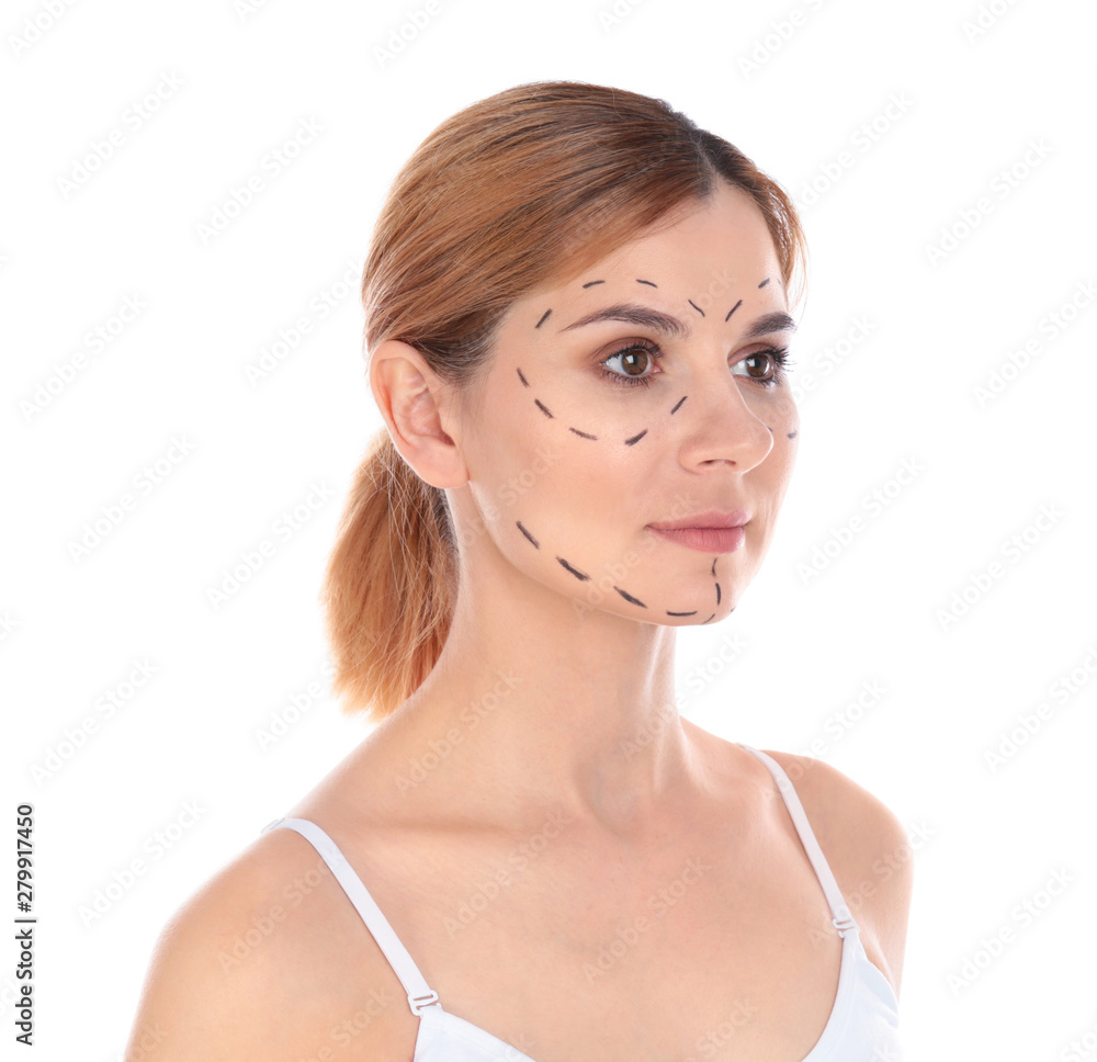 Portrait of woman with marks on face for cosmetic surgery operation against white background Portrait of woman with marks on face for cosmetic surgery operation against white background