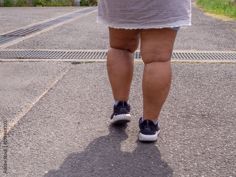 Close up leg fat women running shoes is walking on the street alone. Close up leg fat women running shoes is walking on the street alone.