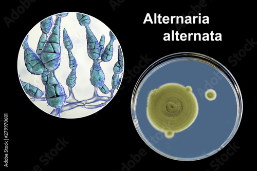 Mold Alternaria alternata, allergic fungus, 3D illustration and photo of colony on agar plate. Alternaria is the causative agent of plant diseases, is common indoor mold and causes allergy photo