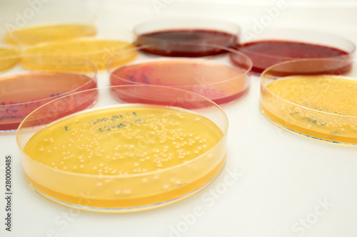 Fotografie Escherichia coli (E