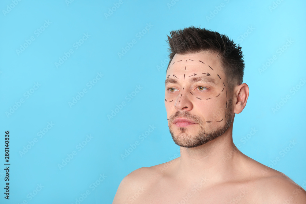 Man with marks on face for cosmetic surgery operation against blue background. Space for text Man with marks on face for cosmetic surgery operation against blue background. Space for text