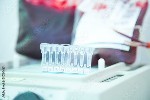 Laboratory testing.compatibility between donor blood and patient blood. crossmatch ,gel method.