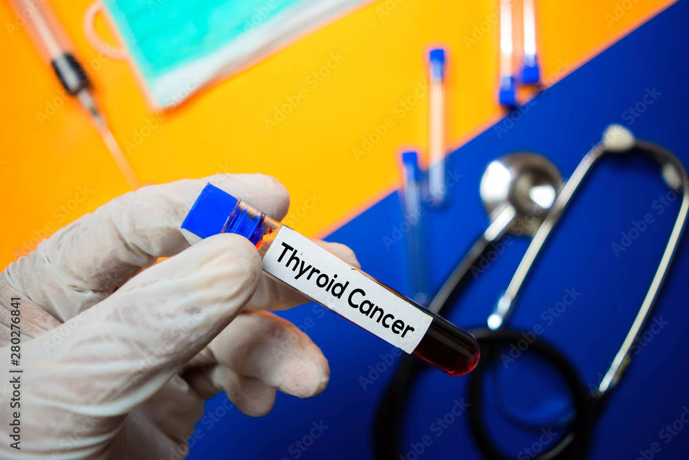 Thyroid Cancer with blood sample. Top view isolated on color background. Healthcare/Medical concept Thyroid Cancer with blood sample. Top view isolated on color background. Healthcare/Medical concept