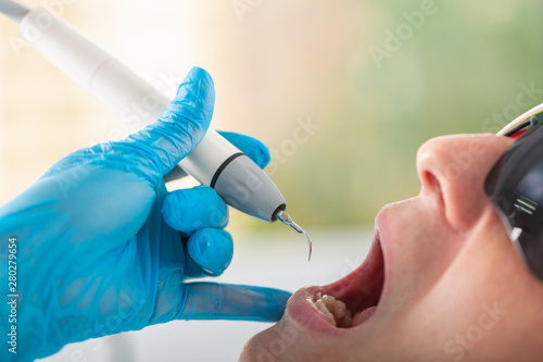 Ultrasonic teeth cleaning, close-up. Removal of tartar, plaque. Paradontitis, paradantoz. Dentistry, healthy teeth, beautiful smile. photo