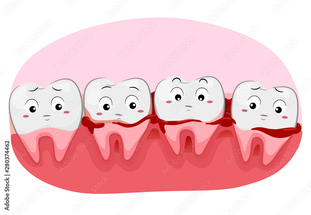 Obraz premium Teeth Mascot Bleeding Gums Illustration