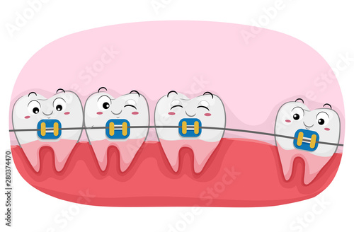 Teeth Mascot Braces Illustr...
