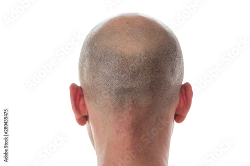 Fotografia Bald man head on the back