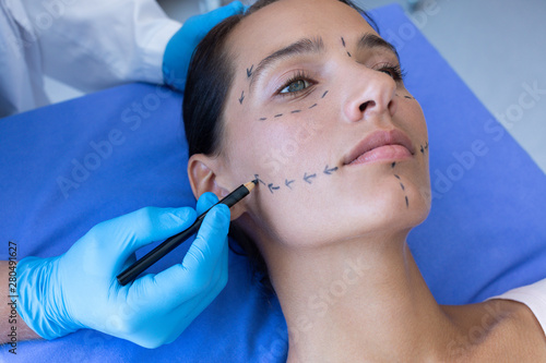 Male surgeon marking woman face before surgery in hospital