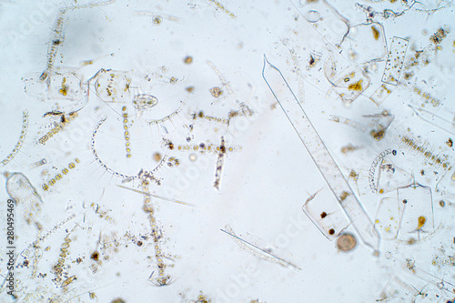 Marine aquatic plankton under microscope view. © tonaquatic