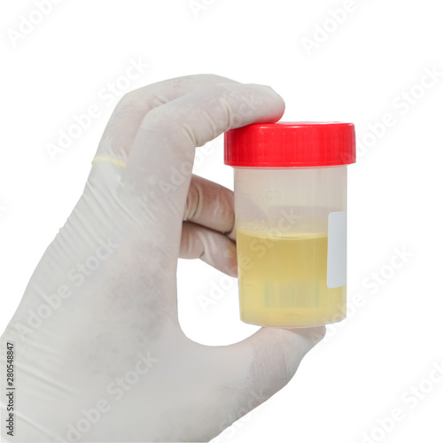 Hand holding urine bottom on white background.