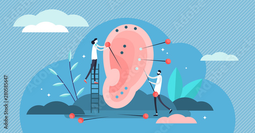 Acupuncture vector illustration. Flat tiny needle therapy persons concept.