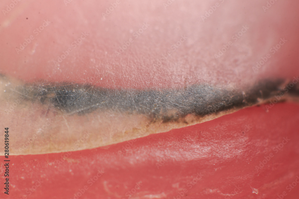 Fototapeta premium Dirt stuck under the man nail super macro