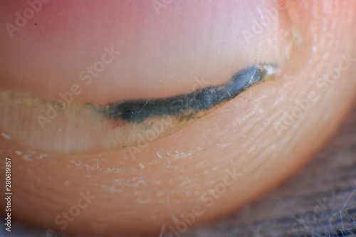 Photography Dirt stuck under the man nail super macro