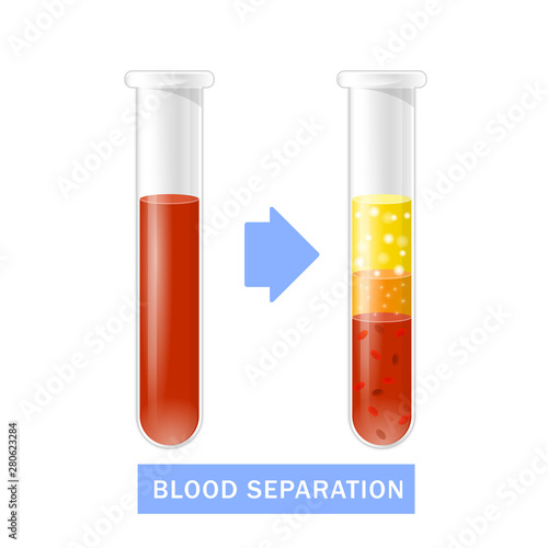 Test tube with blood after separation of platelets, PRP infographics, platelet-rich plasma