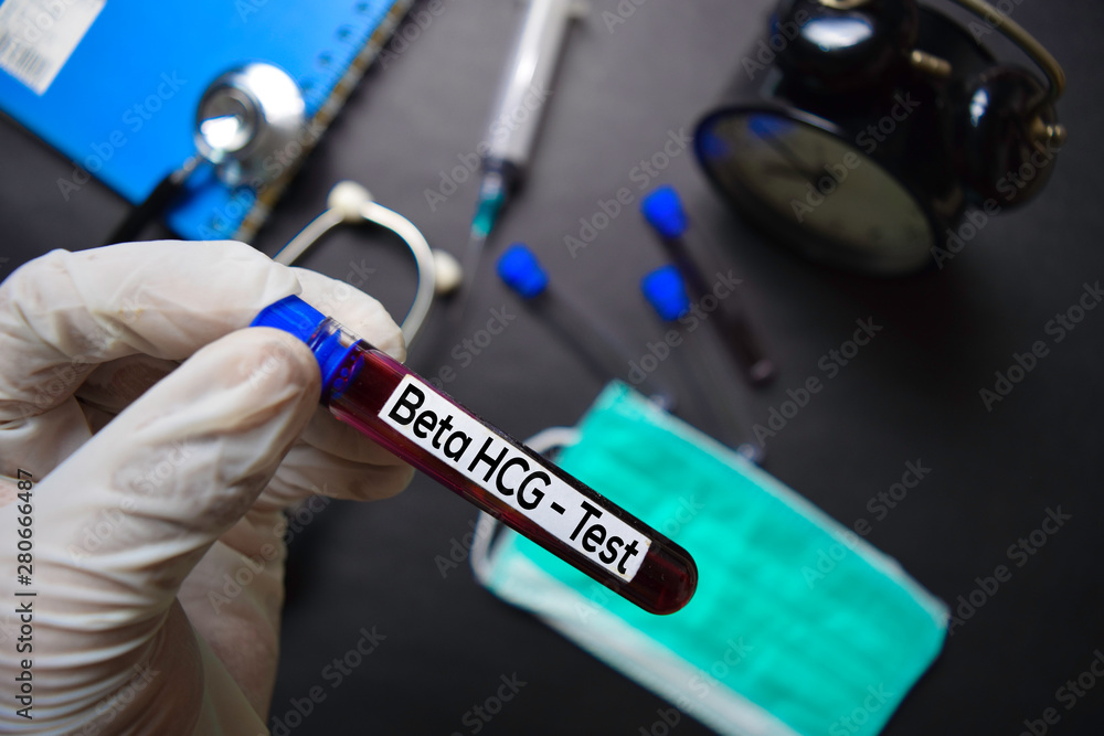 Beta HCG - Test with blood sample. Top view isolated on black background. Healthcare/Medical concept Beta HCG - Test with blood sample. Top view isolated on black background. Healthcare/Medical concept