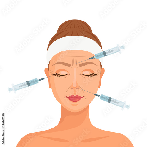 Cosmetic procedure of neurotoxin injection. Facial injections against wrinkles and aging. Beauty treatments. Vector illustration in cartoon style.