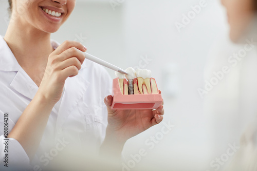 Foto Mid section closeup of smiling female dentist holding tooth model while consulti
