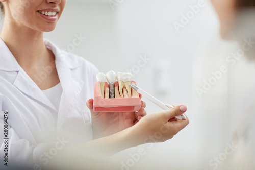 Closeup of smiling female dentist pointing at tooth model while consulting patient in clinic, copy space photo