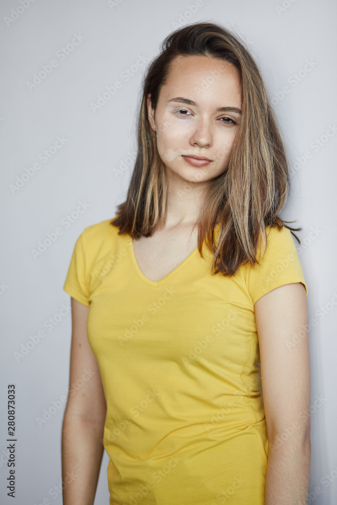 girl in yellow stylish T-shirt has many white spots on her face. isolated white background, studio shot girl in yellow stylish T-shirt has many white spots on her face. isolated white background, studio shot