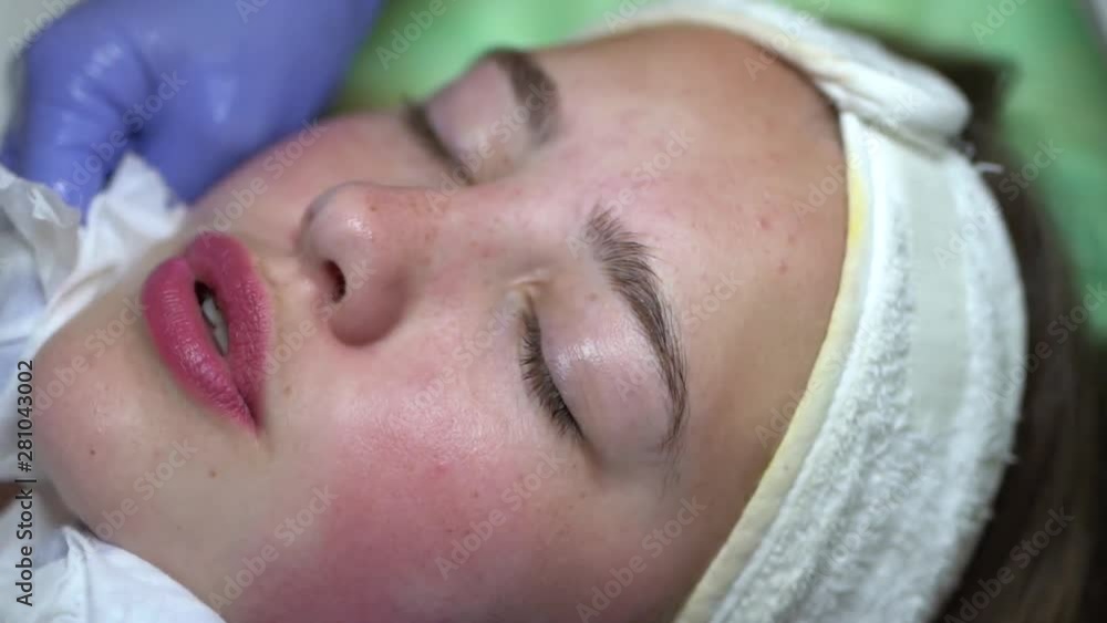 Pink face being wiped for beauty mesotherapy treatment, close up Pink face being wiped for beauty mesotherapy treatment, close up