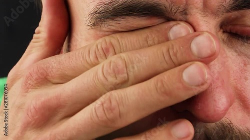 human scratches  his eye with red allergic reaction, redness and peeling psoriasis on face skin, seasonal dermatology problem, close-up  