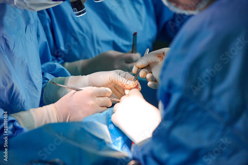 Hands hold syringes to carry fat during work. The operation to transfer fat from one part of the body to another. Platsichiskaya surgery, beauty, change of appearance.