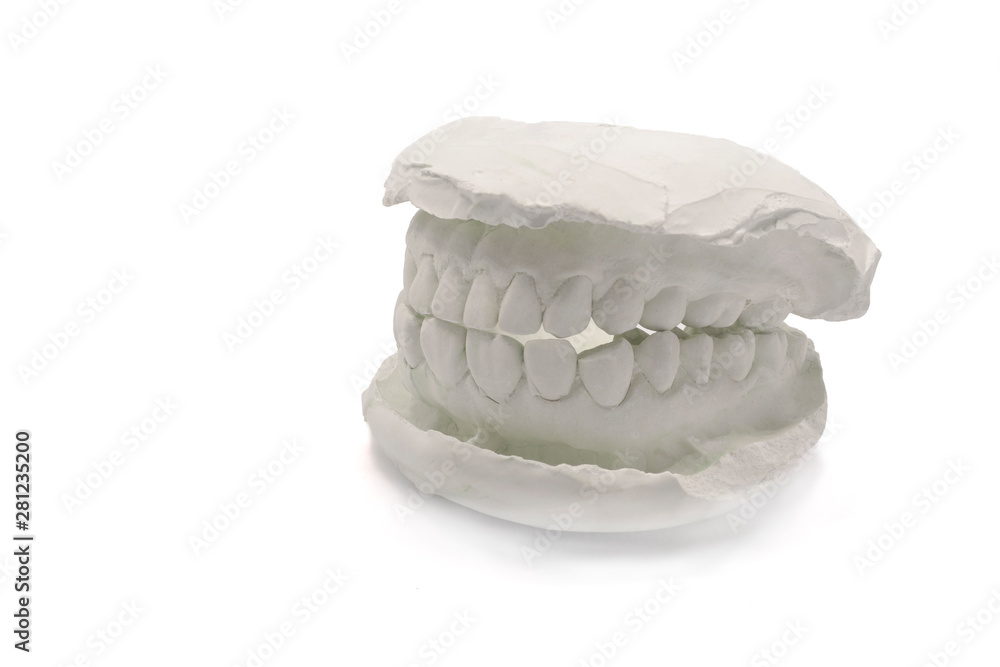 Dental model plaster on white background,isolated.Plaster model jaw with artificial dental designs with clipping path Dental model plaster on white background,isolated.Plaster model jaw with artificial dental designs with clipping path