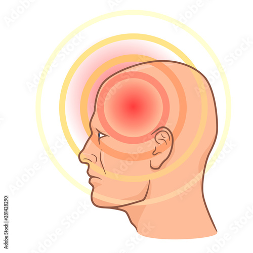 Head pain