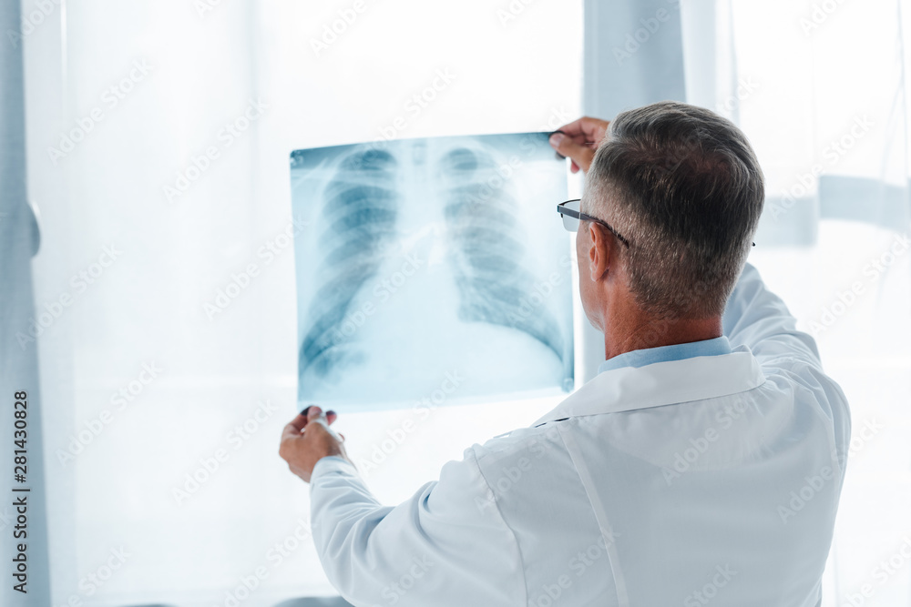 back view of doctor in white coat holding x-ray in hospital