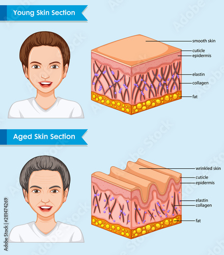 Scientific medical illustration of young and aged skin